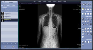 software para imágenes médicas