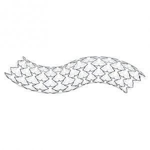 stent arteria ilíaca 1