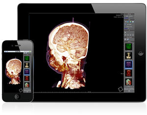 software para imágenes médicas