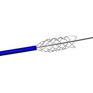 stent de titanio 1
