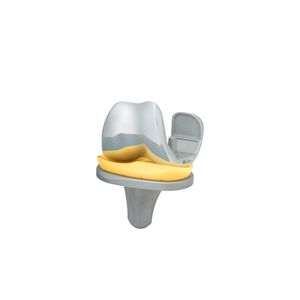 prótesis de rodilla tricompartimental 1