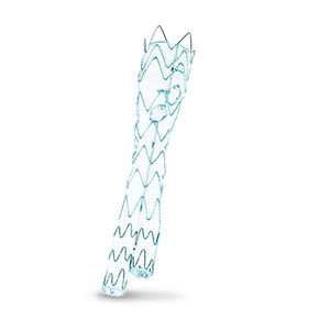 stent-injerto aorta abdominal