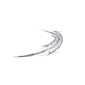 stent arteria coronaria