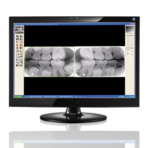 software para imagen dental