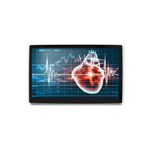 monitor médico 1