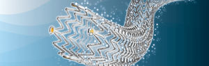 stent periférico 1