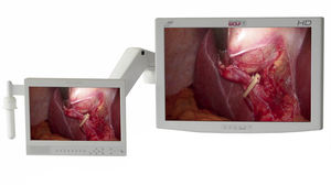 monitor para endoscopia