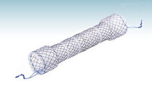 stent esofágico 1