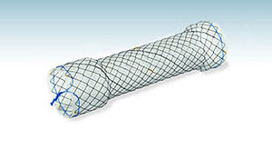 stent colorrectal
