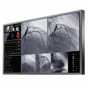 monitor para sala de operaciones