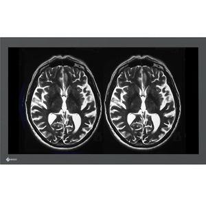 monitor médico 1