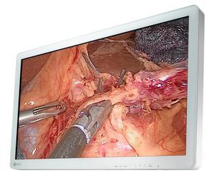 monitor para sala de operaciones