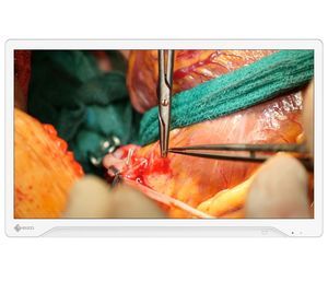 monitor para endoscopia 1