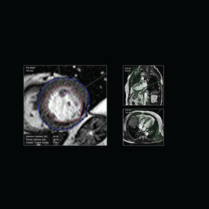 software para cardiología / para IRM / de análisis / para informes