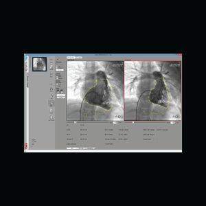 software para imágenes médicas