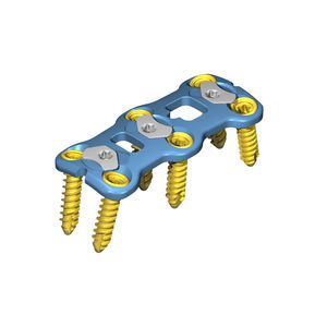placa de compresión cervical