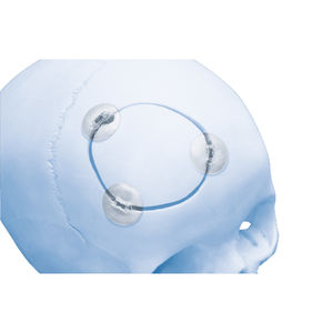 sistema de fijación craneal reabsorbible 1