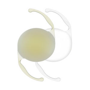 lente intraocular monofocal 1