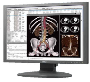 monitor para imágenes médicas 1