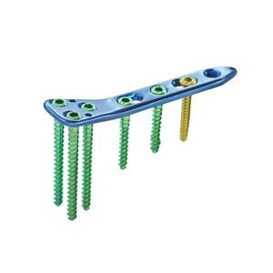 placa de osteotomía para tibia