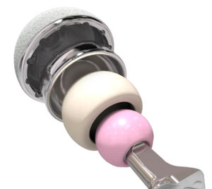 prótesis acetabular no cementada