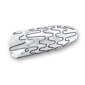 stent uretral