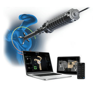 software de planificación preoperatoria 1