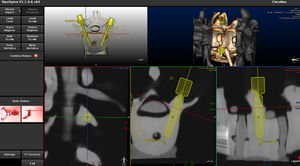 software para cirugía asistida por robot