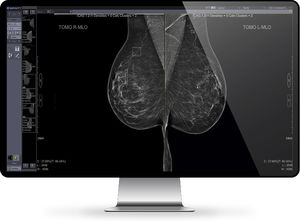 PACS para imágenes médicas 1