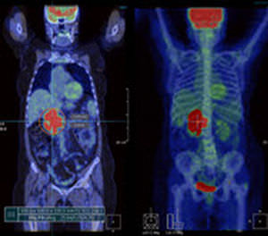 software para imágenes médicas