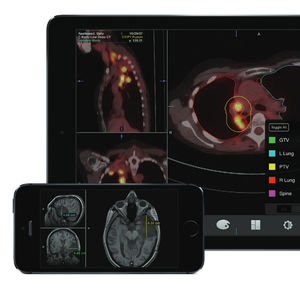 aplicación para iOS para imágenes médicas