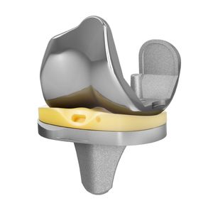 prótesis de rodilla tricompartimental 1