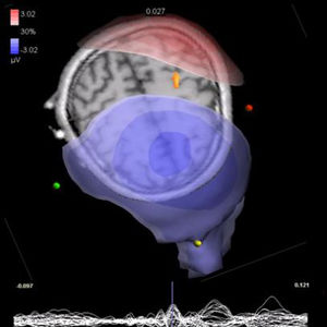 software de visualización / de análisis / para IRM / para EEG