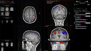 software de control de calidad / de análisis / para informes / para MRI functional