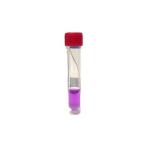 tubo de muestras de laboratorio