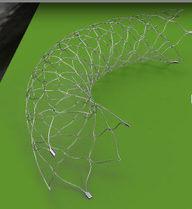 stent intracraneal