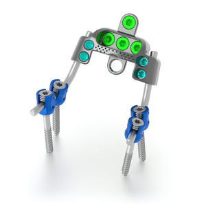 sistema de osteosíntesis occipitocervicotorácico 1