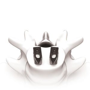 caja intersomática toracolumbar 1