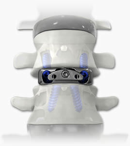 caja intersomática cervical