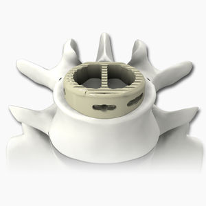 caja intersomática lumbar 1