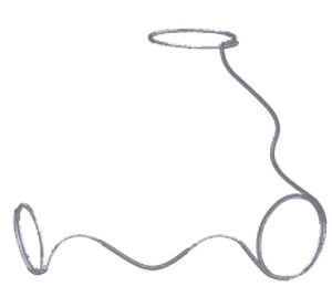 espiral de embolización