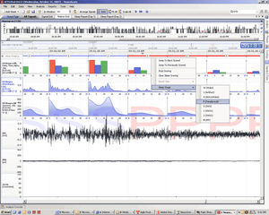 software para estimulación neurofisiológica