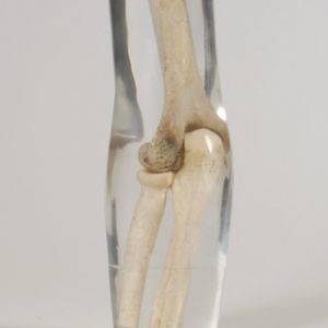fantoma de prueba para radiología 1