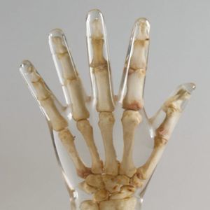 fantoma de prueba para radiología 1