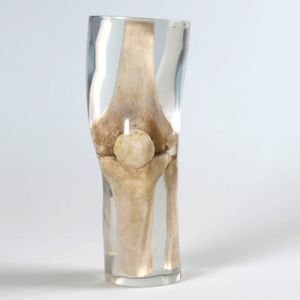 fantoma de prueba para radiología