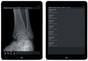 aplicación para iOS para imágenes médicas