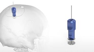 sistema de fijación craneal no reabsorbible