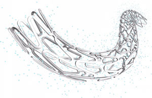 stent arteria coronaria