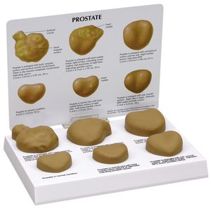 modelo anatómico de próstata 1