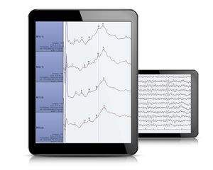 software para EEG